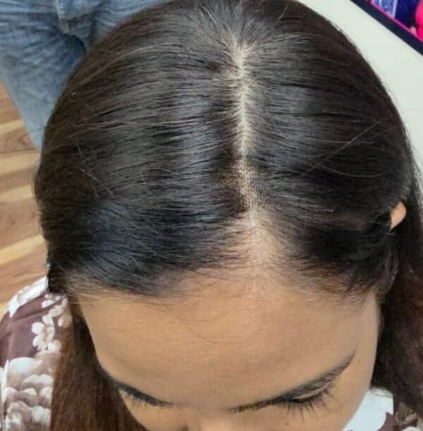 SilkBase -HairTopper For Invisible Hair Line 2×3 Length 16 Inches 100%Human Hair